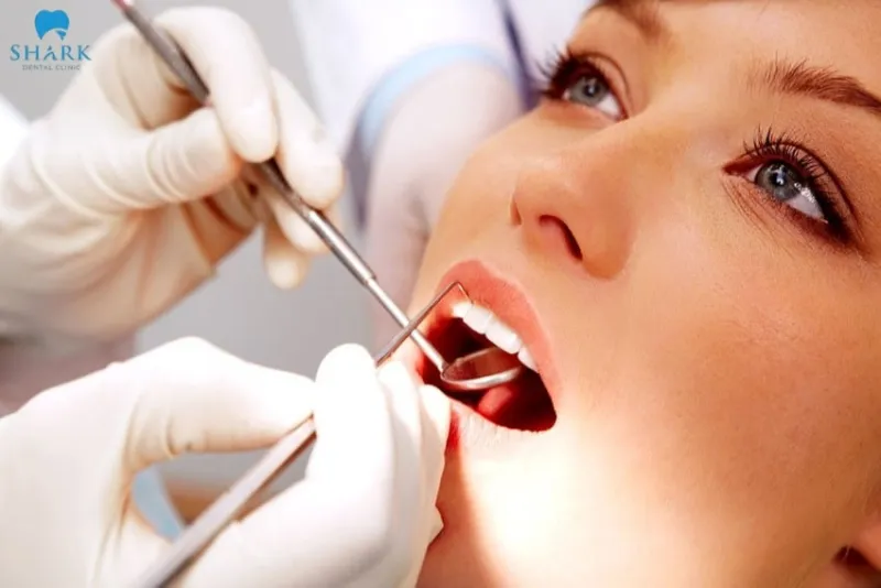 Top 5 vật liệu trám răng phổ biến hiện nay 9 Vật liệu trám răng là gì
