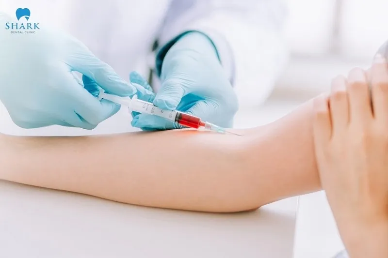 Xét nghiệm máu giúp bác sĩ xác định tình trạng sức khỏe của khách hàng, từ đó đưa ra quyết định có nên nhổ răng khôn hay không