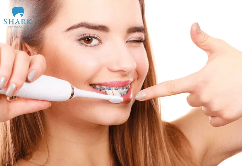 Top 5 loại bàn chải cho người niềng răng 15 Vệ sinh răng miệng đúng cách giúp bảo vệ răng và nướu khi niềng