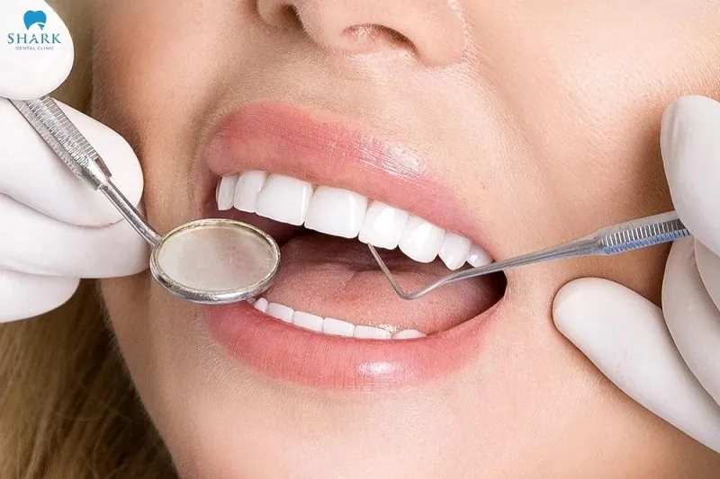 Chăm sóc răng sứ đúng cách giúp ngăn ngừa răng sứ ngả màu và kéo dài tuổi thọ của chúng