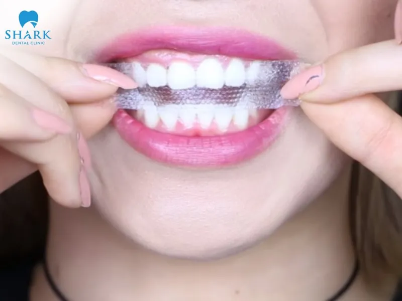 Cách làm trắng răng sau 1 đêm tại nhà an toàn, hiệu quả nhất 19 Miếng dán trắng răng có khả năng loại bỏ vết ố vàng trên men răng
