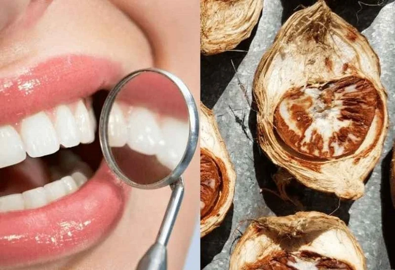 2 cách ngâm rượu cau chữa sâu răng hiệu quả và an toàn 6 Mẹo dân gian ngậm rượu cau giúp chắc răng và kháng khuẩn