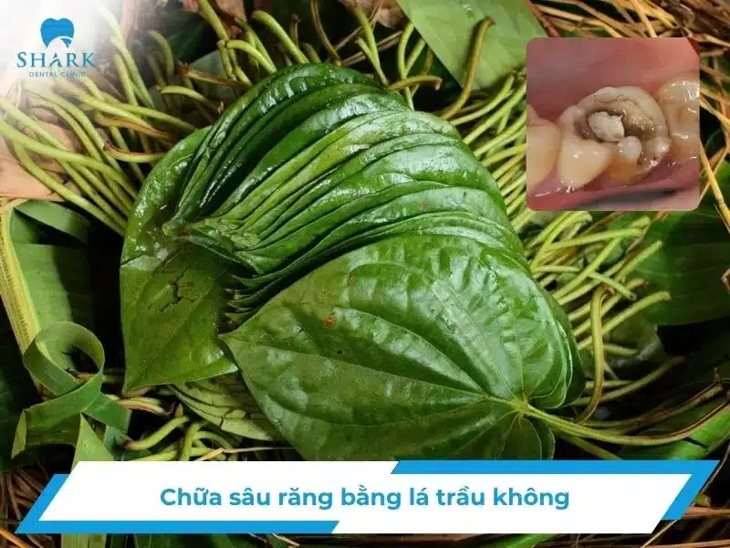 Chữa sâu răng bằng lá trầu không