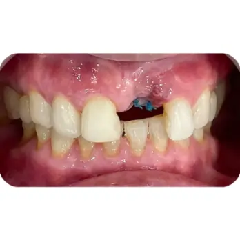 khach hang boc rang su o shark 2 1