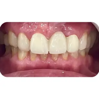 khach hang boc rang su o shark 3 1