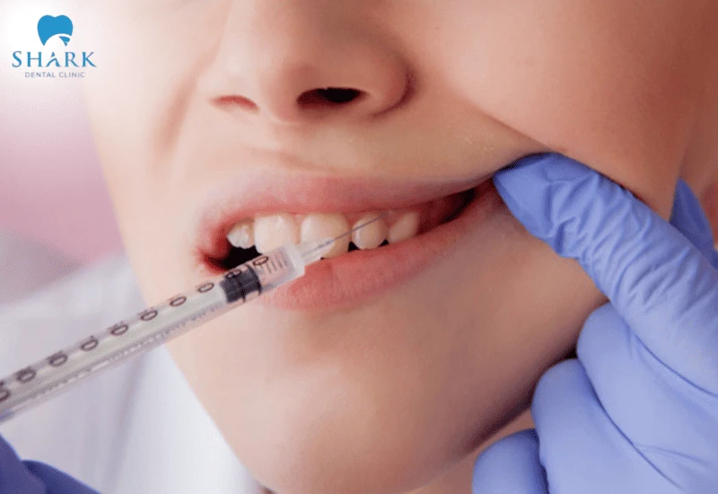 Tiêm thuốc tê trong quá trình lấy tủy răng