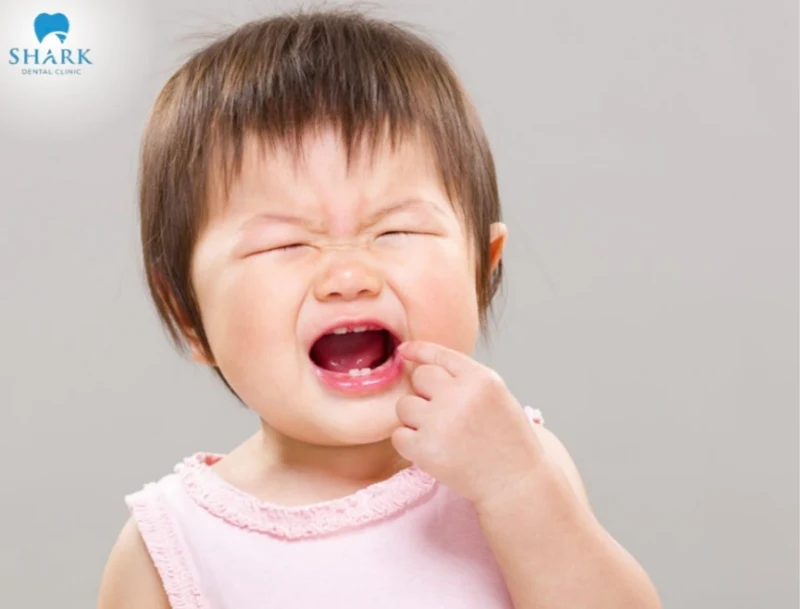 Trẻ bị sâu răng ăn vào tủy: Nguyên nhân, dấu hiệu và quy trình điều trị 7 Trẻ đau vì bị sâu răng ăn vào tủy