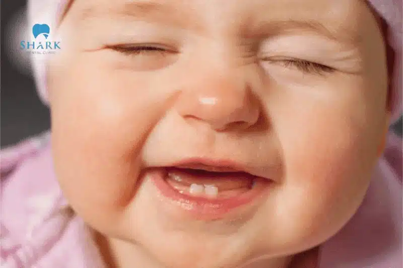 Trẻ mấy tháng mọc răng? Thứ tự mọc răng và dấu hiệu mọc răng của trẻ 13 Mọc răng là một giai đoạn đặc biệt trong quá trình phát triển của trẻ