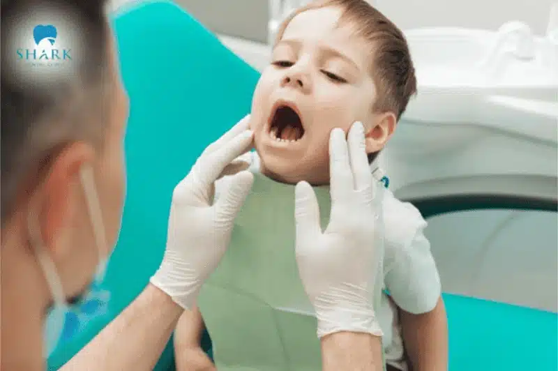 Trẻ mấy tháng mọc răng? Thứ tự mọc răng và dấu hiệu mọc răng của trẻ 22 Nên đưa trẻ đến Nha khoa nếu xuất hiện nhiều dấu hiệu bất thường