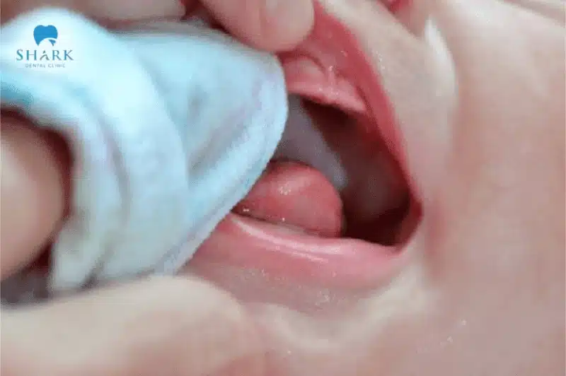 Trẻ mấy tháng mọc răng? Thứ tự mọc răng và dấu hiệu mọc răng của trẻ 20 Dùng khăn lạnh để làm dịu nướu cho