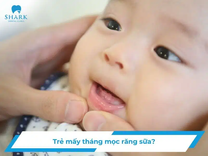 Trẻ mấy tháng mọc răng sữa
