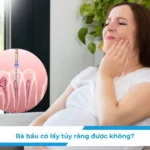 Bà bầu có lấy tủy răng được không