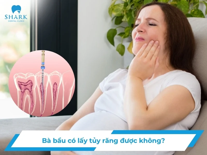 Bà bầu có lấy tủy răng được không