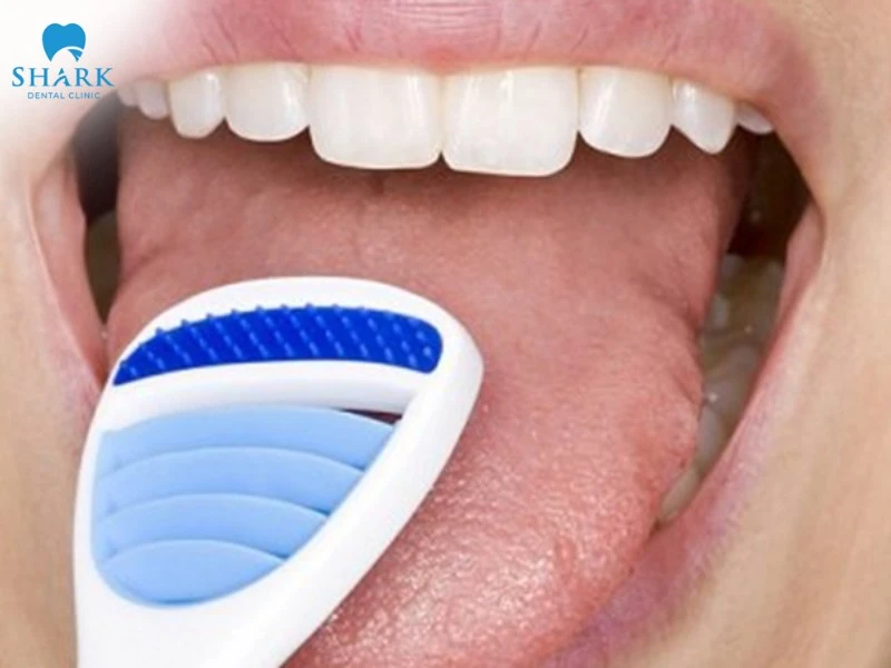 TOP 10 cách làm thơm miệng giúp bạn tự tin cả ngày dài 14 Cạo lưỡi giúp loại bỏ các tác nhân gây hôi miệng