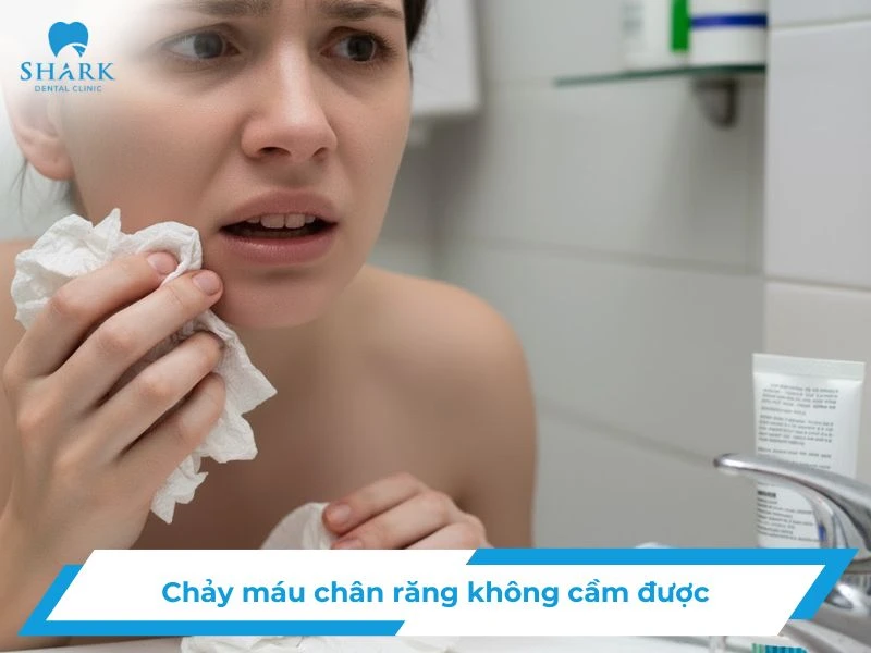 Chảy máu chân răng không cầm được