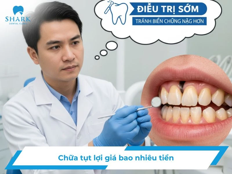 Chữa tụt lợi giá bao nhiêu tiền? Giá điều trị lợi tháng 11/2025 9 Chữa tụt lợi giá bao nhiêu tiền