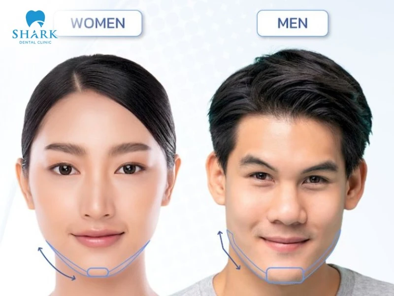 Jawline giúp tôn lên nét mạnh mẽ của nam giới và vẻ thanh thoát dịu dàng của nữ giới