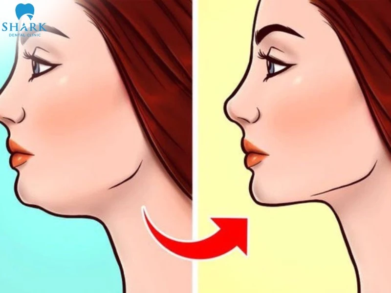 Kiên trì luyện tập kết hợp với chế độ ăn lành mạnh, đường Jawline trở nên rõ ràng và cuốn hút hơn