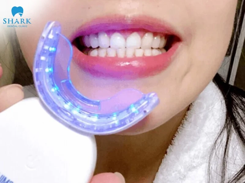 Kit trắng răng Smilee có tốt không? Khi sử dụng cần lưu ý gì? 11 Hiệu quả của máy làm trắng răng Smilee