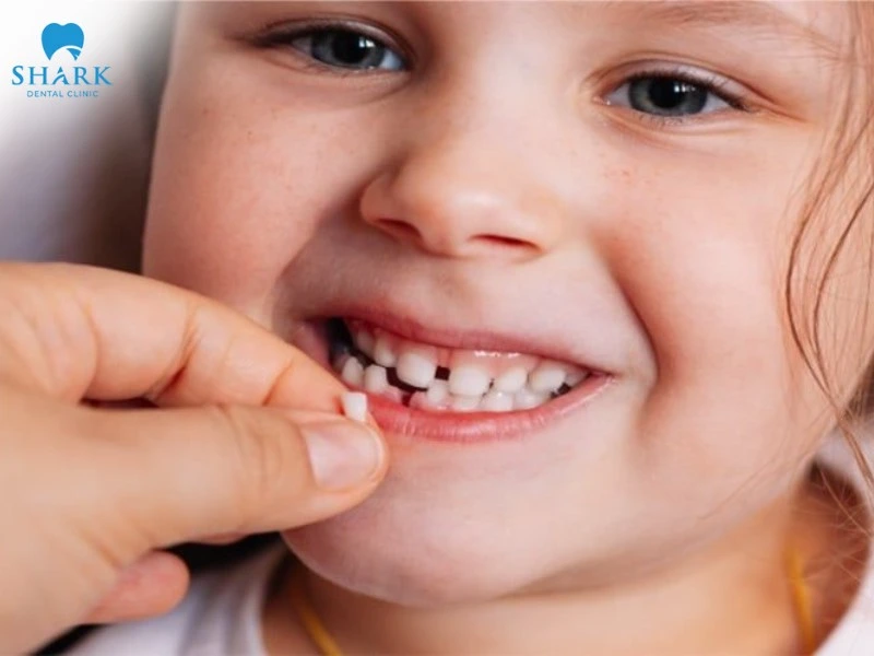 Đây là giai đoạn duy nhất mà việc nhổ/ rụng răng sẽ có răng mới mọc lên thay thế