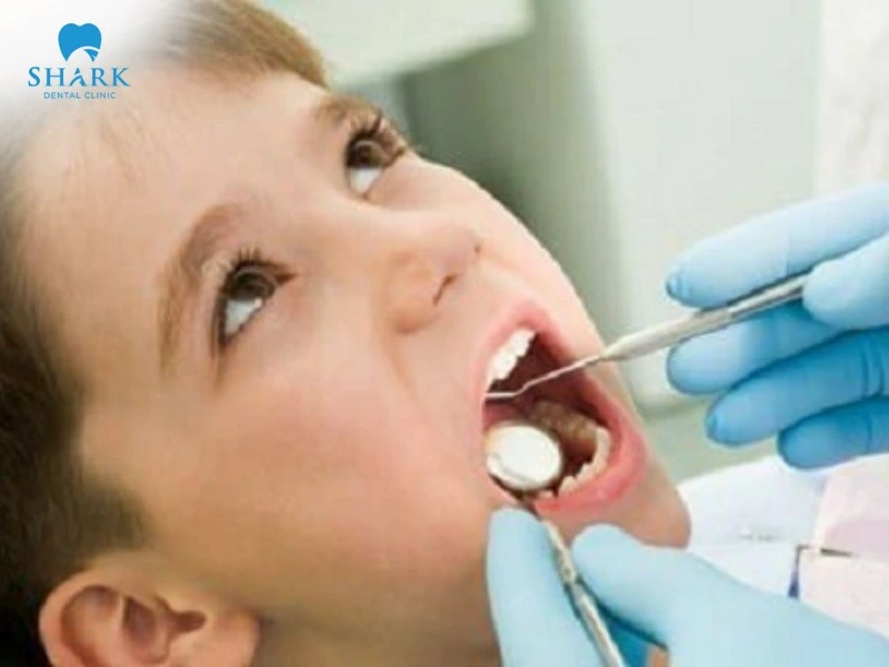 Khám răng định kỳ 3 - 6 tháng/lần để kiểm tra tình trạng của răng