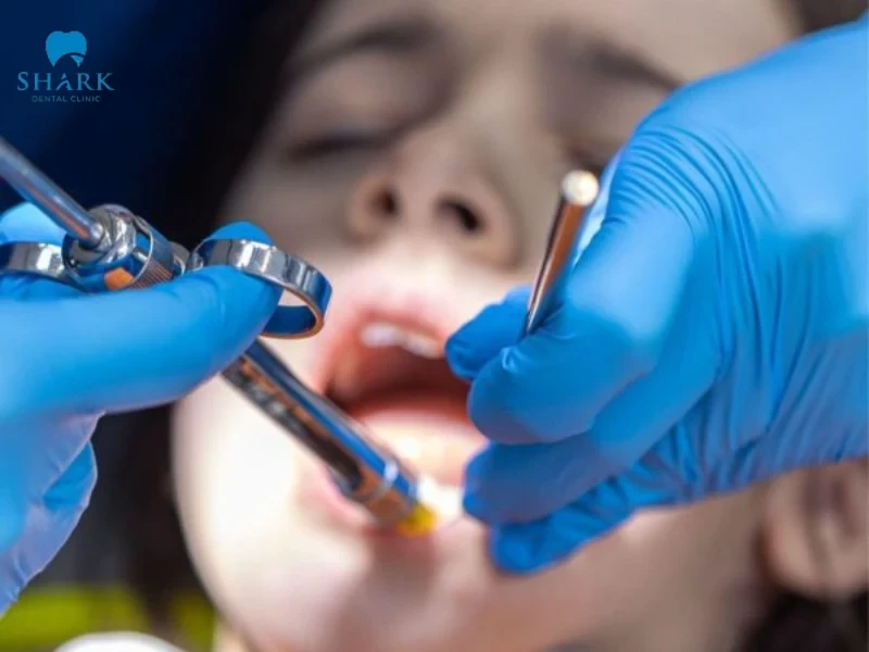 Trẻ em không nên trồng răng Implant cho đến khi xương hàm trưởng thành