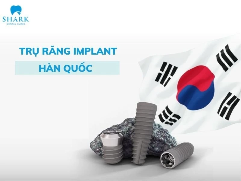 Trụ Implant Hàn Quốc là chân răng nhân tạo được chế tác từ Titanium tinh khiết, sản xuất tại bởi những công ty y tế hàng đầu ở xứ sở kim chi