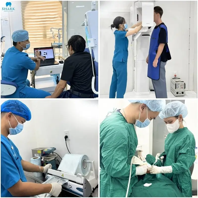 Quy trình cấy ghép Implant Hàn Quốc được thực hiện theo trình tự chuyên nghiệp, bài bản