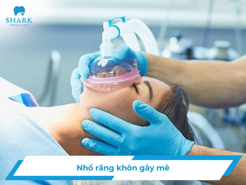 Nhổ răng khôn gây mê là gì? Có nên lựa chọn và cần lưu ý gì? 18 Nhổ răng khôn gây mê.