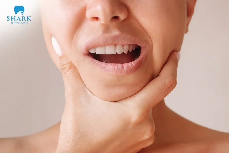 Áp xe răng khôn là gì? Nguyên nhân gây ra tình trạng này 22 vùng hàm bị cứng