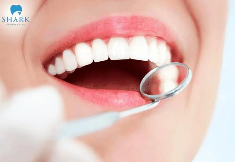 Vệ sinh răng miệng duy trì răng trắng sáng