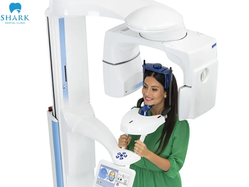 Chụp phim Panorama răng