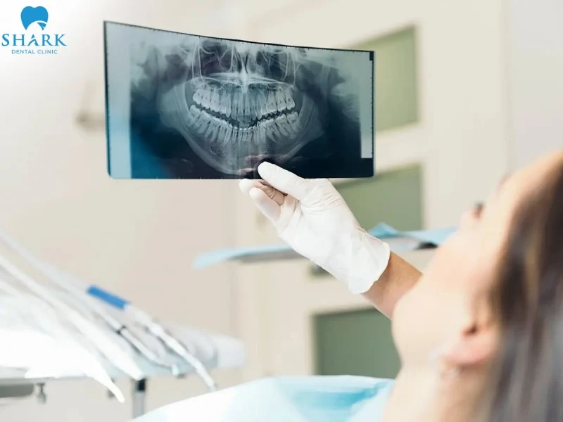 Kết quả được trả ra chỉ trong 1 phim