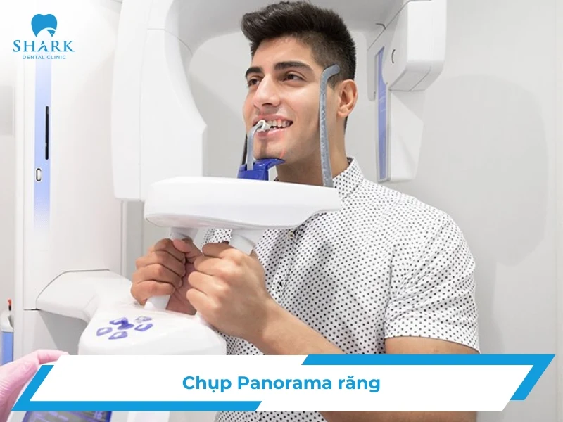 Chụp Panorama răng là gì? Giá chụp phim răng Panorama 16 Chụp Panorama răng