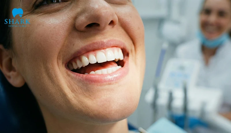 Hình ảnh minh họa so sánh răng trước và sau khi lấy cao răng, thể hiện rõ sự sạch sẽ và loại bỏ mảng bám