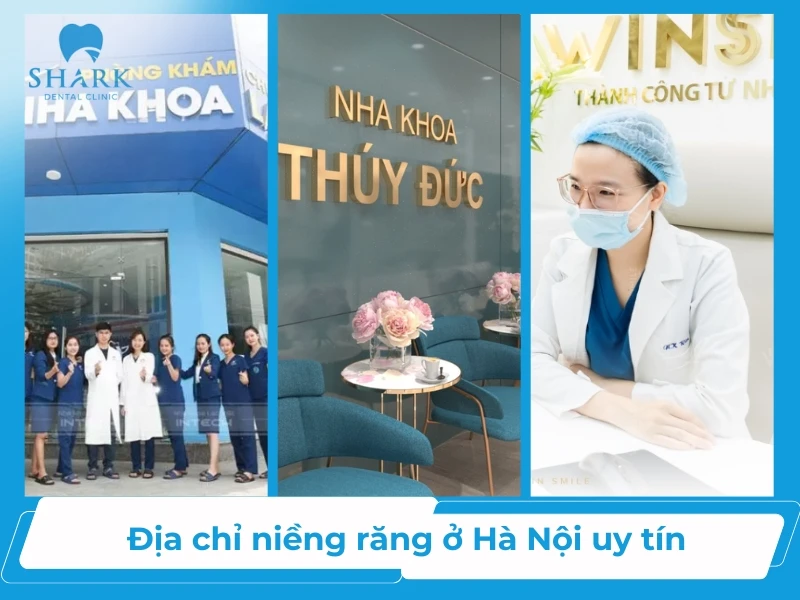 TOP 10 địa chỉ niềng răng ở Hà Nội uy tín và an toàn 12 Tổng hợp các địa chỉ niềng răng tốt ở Hà Nội
