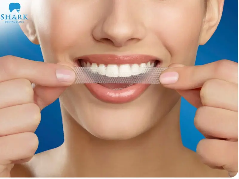 Hình dạng miếng dán tẩy trắng răng 