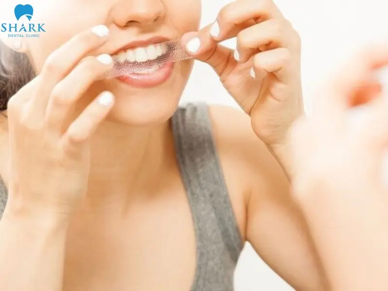 Vệ sinh răng miệng trước khi sử dụng miếng dán trắng răng