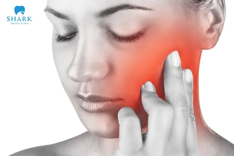 Mọc răng khôn hàm trên: Những vấn đề thường gặp và cách xử lý an toàn 12 mọc răng khôn hàm trên gây đau nhức, khó chịu