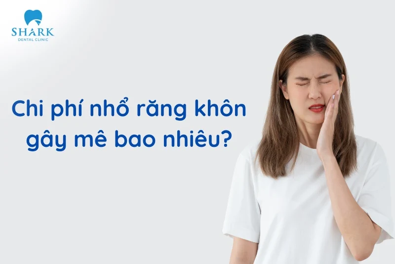 Nhổ răng khôn gây mê là gì? Có nên lựa chọn và cần lưu ý gì? 17 Chi phí nhổ răng khôn gây mê