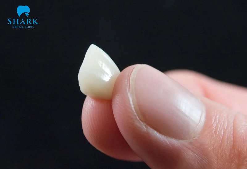 Tại sao bọc răng sứ bị rớt ra? Cách dán răng giả bị rơi ra 10 Răng giả bị rơi thì phải làm sao?