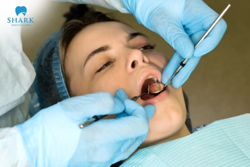 Răng khôn có tác dụng gì? Khi nào nên nhổ răng khôn? 12 Răng khôn mọc đúng hướng được tận dụng trong chỉnh nha.