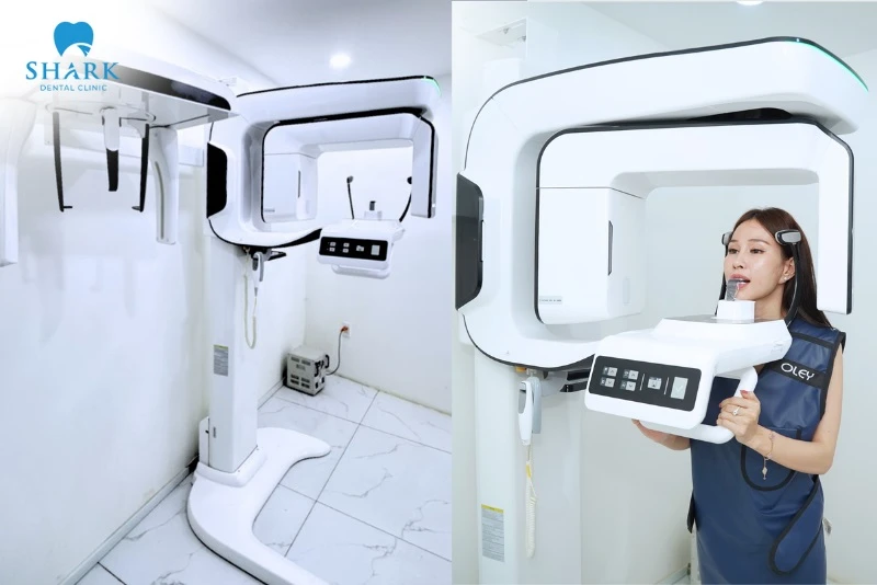 Nha khoa Shark sử dụng máy CT Conebeam 3D.