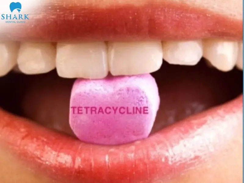 Các nguyên nhân khiến răng nhiễm màu Tetracycline