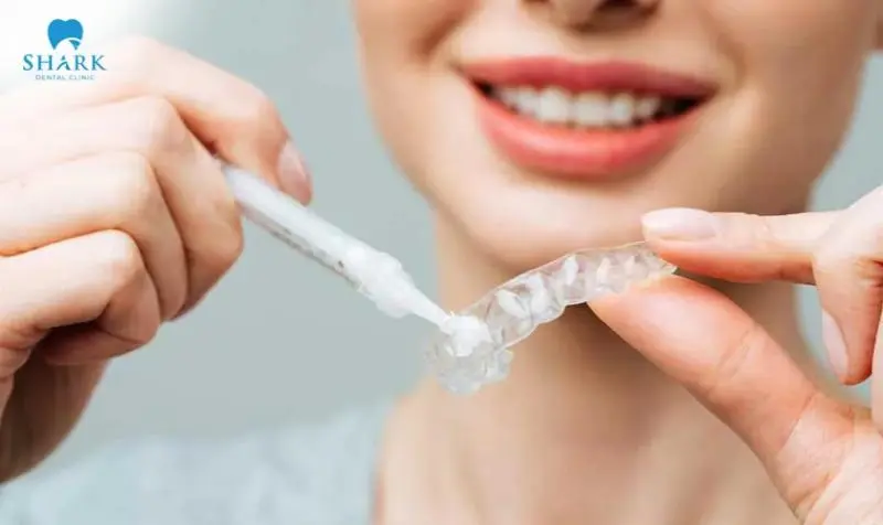 Sử dụng gel tẩy trắng răng bằng máng