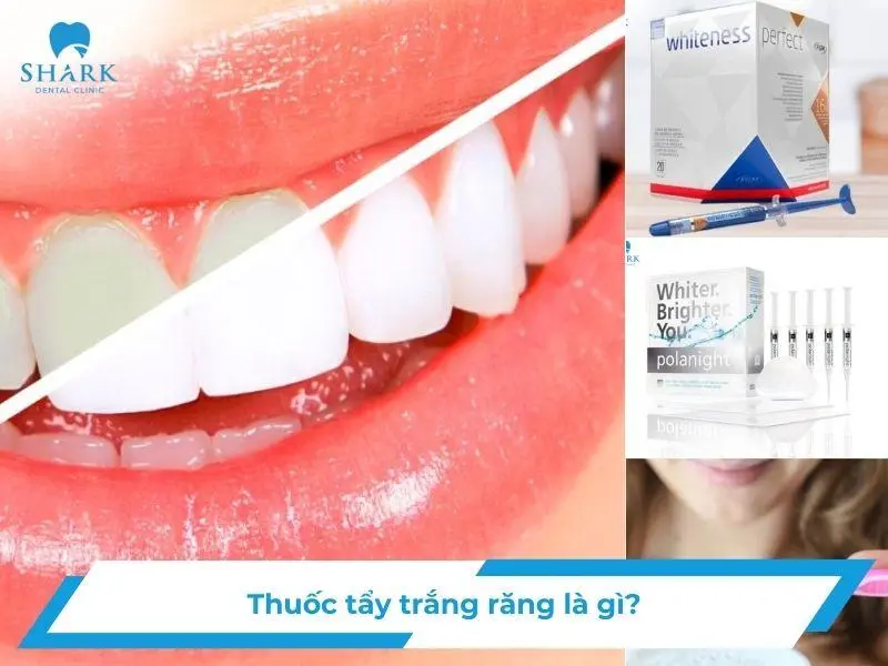 Thuốc tẩy trắng răng