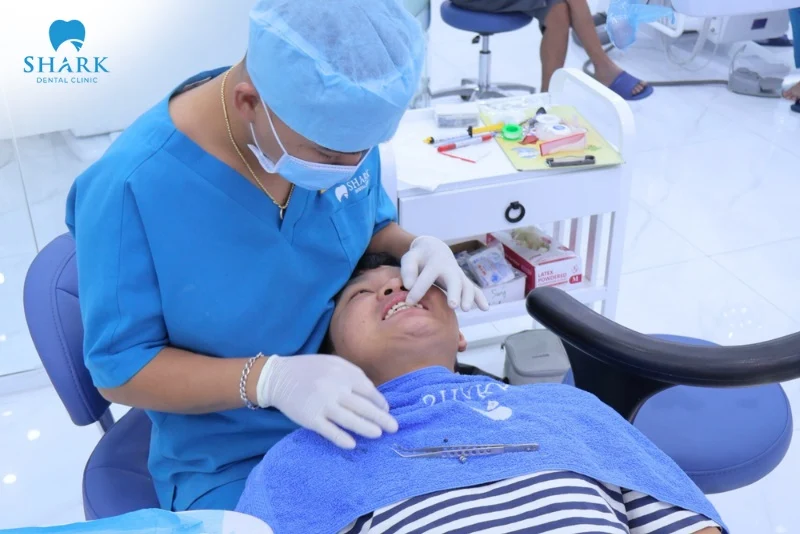 thực hiện tiểu phẫu răng khôn tại Nha khoa Shark giúp bạn an tâm về giá cả & quy trình nhổ an toàn
