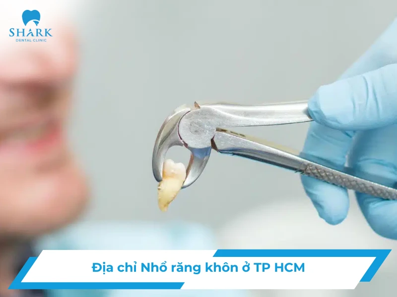 dia-chi-nho-rang-khon-o-tp-hcm