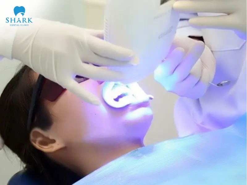 Tẩy trắng răng tại các phòng khám nha khoa uy tín Tẩy trắng răng tại các phòng khám nha khoa uy tín