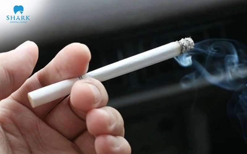 Hút thuốc là nguyên nhân bựa răng tích tụ hằng ngày
